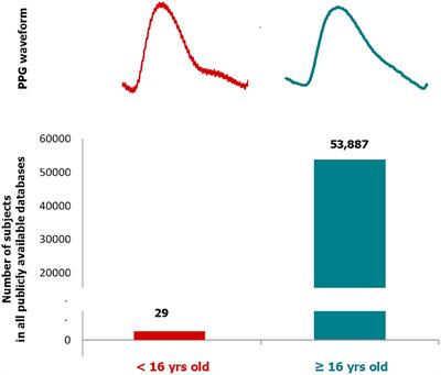 The Striking Need for Age Diverse Pulse Oximeter Databases